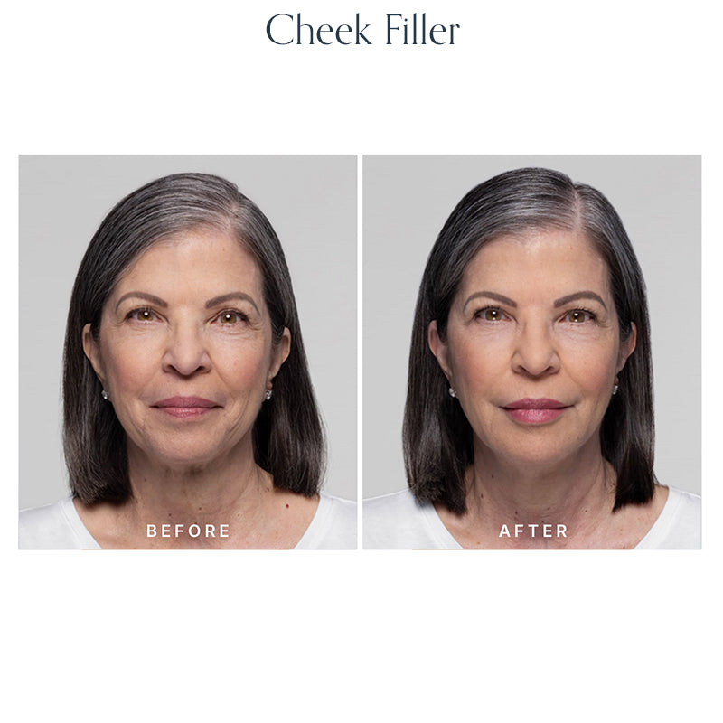 Volume Restore Filler