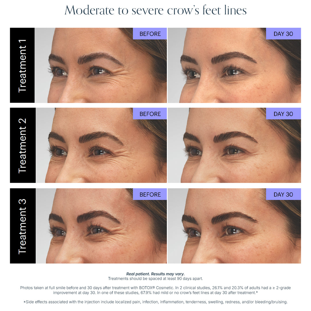 Wrinkle Relaxer