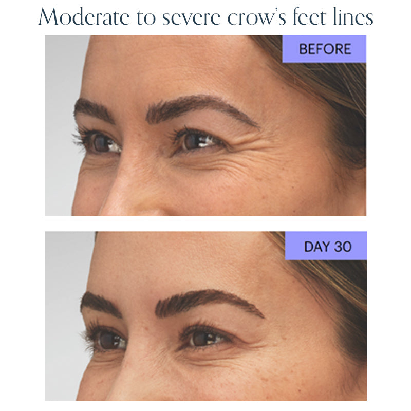 Wrinkle Relaxer