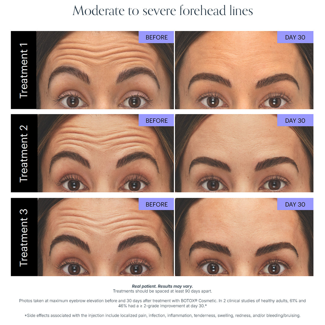 Wrinkle Relaxer