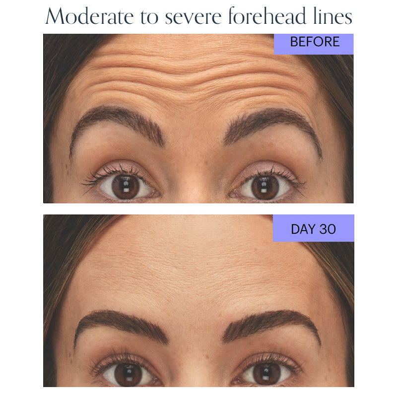 Wrinkle Relaxer