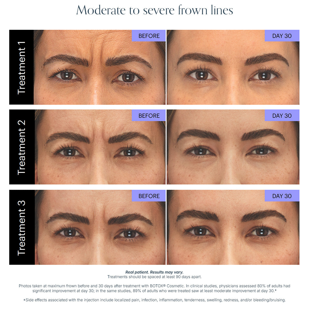Wrinkle Relaxer