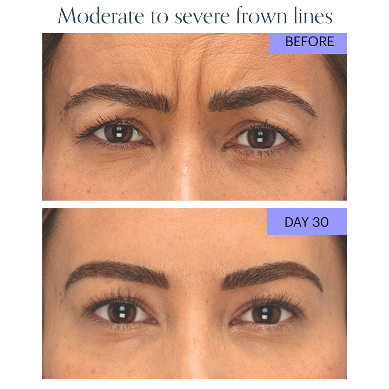 Wrinkle Relaxer